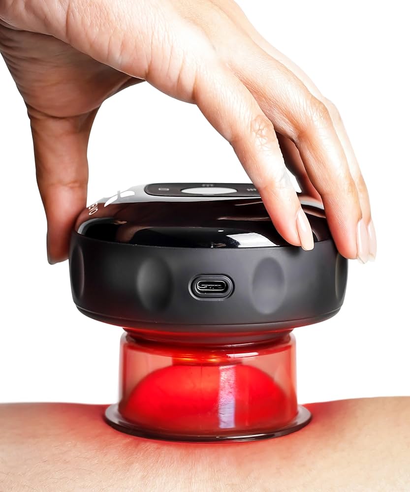 Smart Cupping Therapy Set – Advanced Recovery Technology