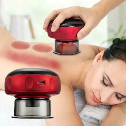 Smart Cupping Therapy Set – Advanced Recovery Technology