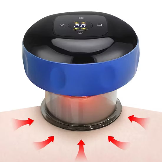 Smart Cupping Therapy Set – Advanced Recovery Technology